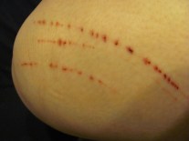 I know from whence I speak.